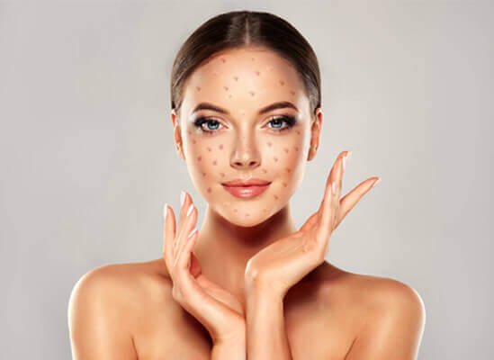 Natural Aesthetics By Lisa's Aesthetics Wonderful Home Natural Remedies